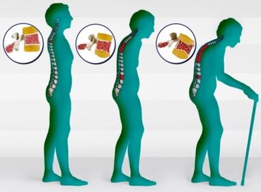 Астэапароз